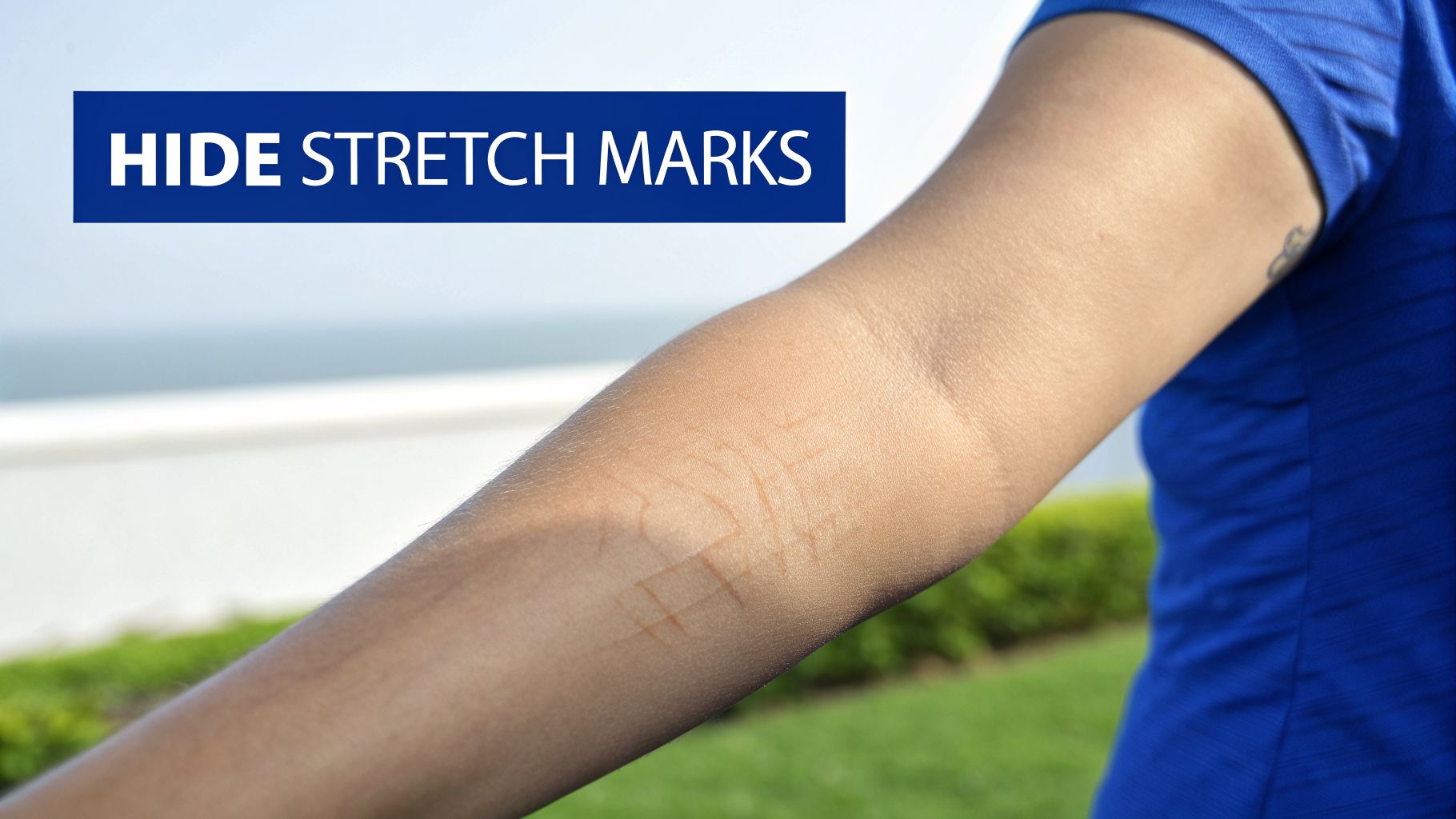 Close-up of a person's arm with visible stretch marks and text 'HIDE STRETCH MARKS'.